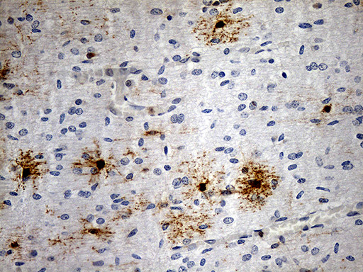 GPR17 Antibody in Immunohistochemistry (Paraffin) (IHC (P))