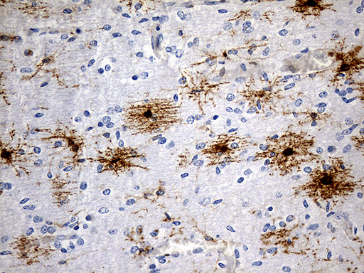 GPR17 Antibody in Immunohistochemistry (Paraffin) (IHC (P))
