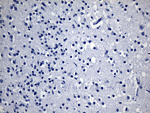 GPR17 Antibody in Immunohistochemistry (Paraffin) (IHC (P))