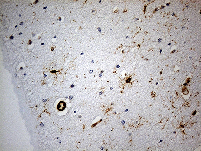 GPR17 Antibody in Immunohistochemistry (Paraffin) (IHC (P))