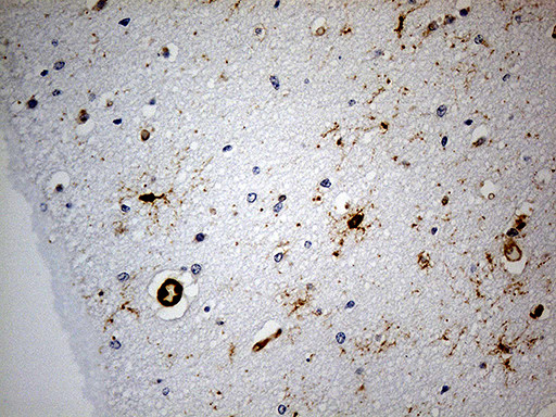 GPR17 Antibody in Immunohistochemistry (Paraffin) (IHC (P))