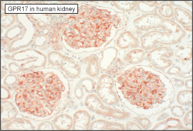 GPR17 Antibody in Immunohistochemistry (Paraffin) (IHC (P))