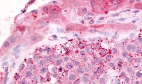 GPR182 Antibody in Immunohistochemistry (Paraffin) (IHC (P))