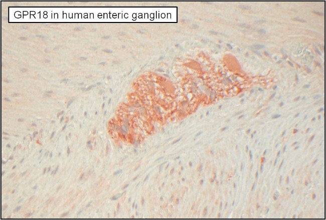 GPR18 Antibody in Immunohistochemistry (Paraffin) (IHC (P))