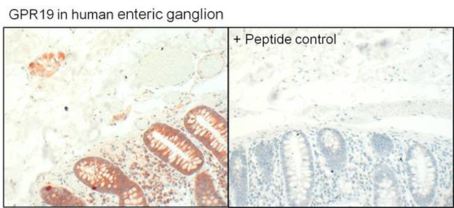 GPR19 Antibody in Immunohistochemistry (Paraffin) (IHC (P))