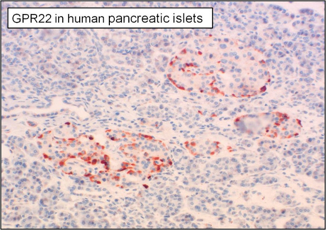 GPR22 Antibody in Immunohistochemistry (Paraffin) (IHC (P))