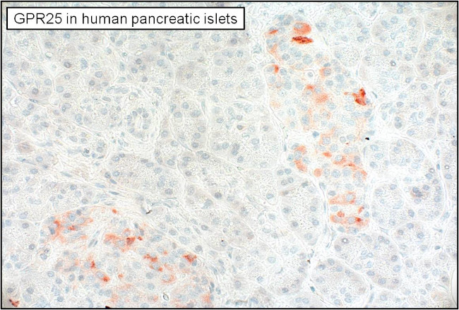GPR25 Antibody in Immunohistochemistry (Paraffin) (IHC (P))