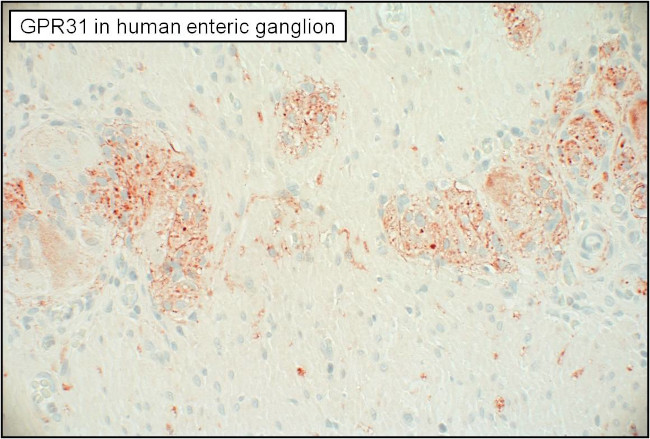 GPR31 Antibody in Immunohistochemistry (Paraffin) (IHC (P))