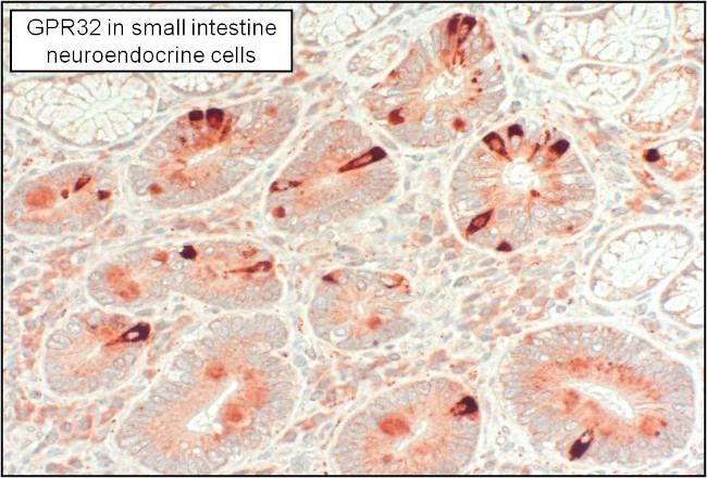 GPR32 Antibody in Immunohistochemistry (Paraffin) (IHC (P))