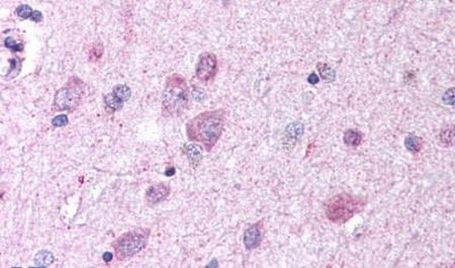 GPR37 Antibody in Immunohistochemistry (Paraffin) (IHC (P))