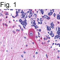 GPR39 Antibody in Immunohistochemistry (IHC)