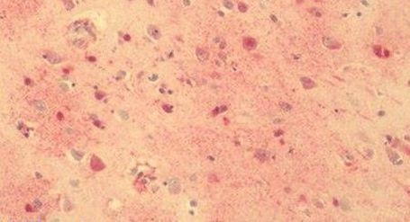 GPR56 Antibody in Immunohistochemistry (Paraffin) (IHC (P))