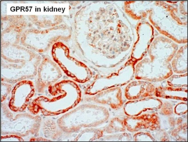 TAAR3 Antibody in Immunohistochemistry (Paraffin) (IHC (P))