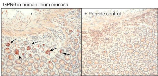 GPR6 Antibody in Immunohistochemistry (Paraffin) (IHC (P))