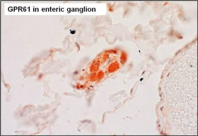 GPR61 Antibody in Immunohistochemistry (Paraffin) (IHC (P))