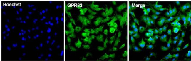 GPR62 Antibody in Immunocytochemistry (ICC/IF)