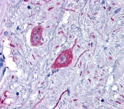 GPR6 Antibody in Immunohistochemistry (Paraffin) (IHC (P))