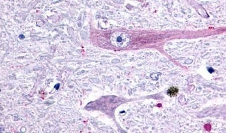 GPR75 Antibody in Immunohistochemistry (Paraffin) (IHC (P))