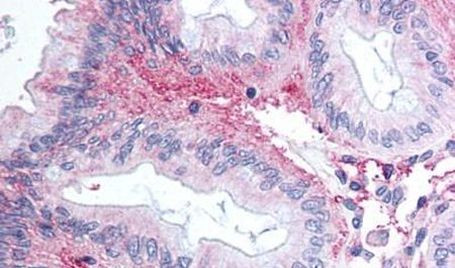 GPR81 Antibody in Immunohistochemistry (Paraffin) (IHC (P))