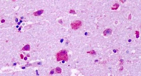 GPR83 Antibody in Immunohistochemistry (Paraffin) (IHC (P))