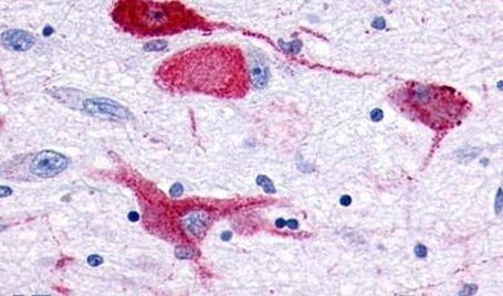GPR83 Antibody in Immunohistochemistry (Paraffin) (IHC (P))