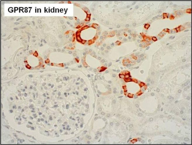 GPR87 Antibody in Immunohistochemistry (Paraffin) (IHC (P))