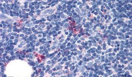 GPR97 Antibody in Immunohistochemistry (Paraffin) (IHC (P))