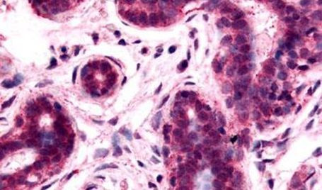 RAI3 Antibody in Immunohistochemistry (Paraffin) (IHC (P))