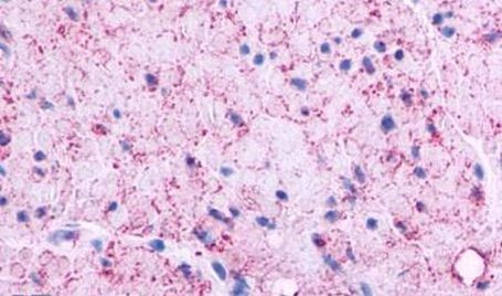 GPRC5C Antibody in Immunohistochemistry (Paraffin) (IHC (P))