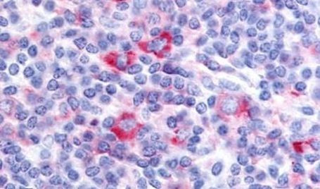 GPRC5D Antibody in Immunohistochemistry (Paraffin) (IHC (P))