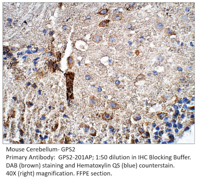GPS2 Antibody in Immunohistochemistry (IHC)