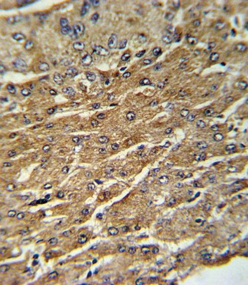 GPT Antibody in Immunohistochemistry (IHC)