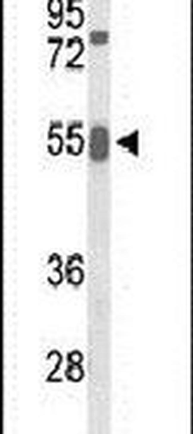 GRB7 Antibody in Western Blot (WB)