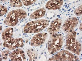 GRHPR Antibody in Immunohistochemistry (Paraffin) (IHC (P))
