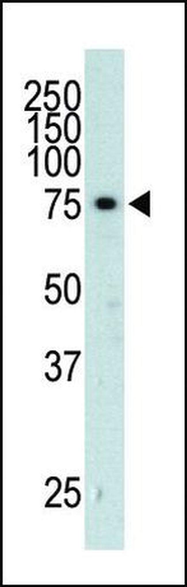GRK3 Antibody in Western Blot (WB)