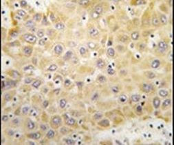GRK5 Antibody in Immunohistochemistry (IHC)