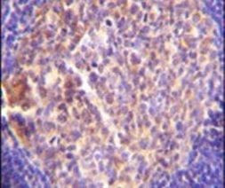 GRK6 Antibody in Immunohistochemistry (IHC)