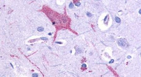 mGluR1 Antibody in Immunohistochemistry (Paraffin) (IHC (P))
