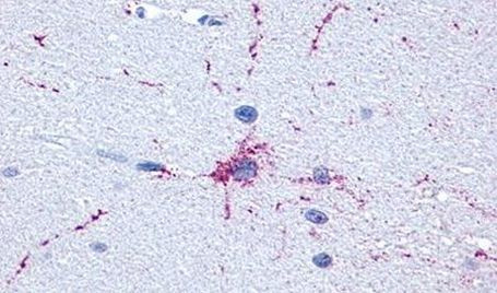 mGluR8 Antibody in Immunohistochemistry (Paraffin) (IHC (P))