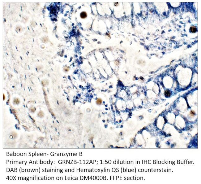 Granzyme B Antibody in Immunohistochemistry (IHC)
