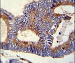 GRP78 Antibody in Immunohistochemistry (IHC)