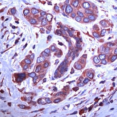 GRP94 Antibody in Immunohistochemistry (IHC)