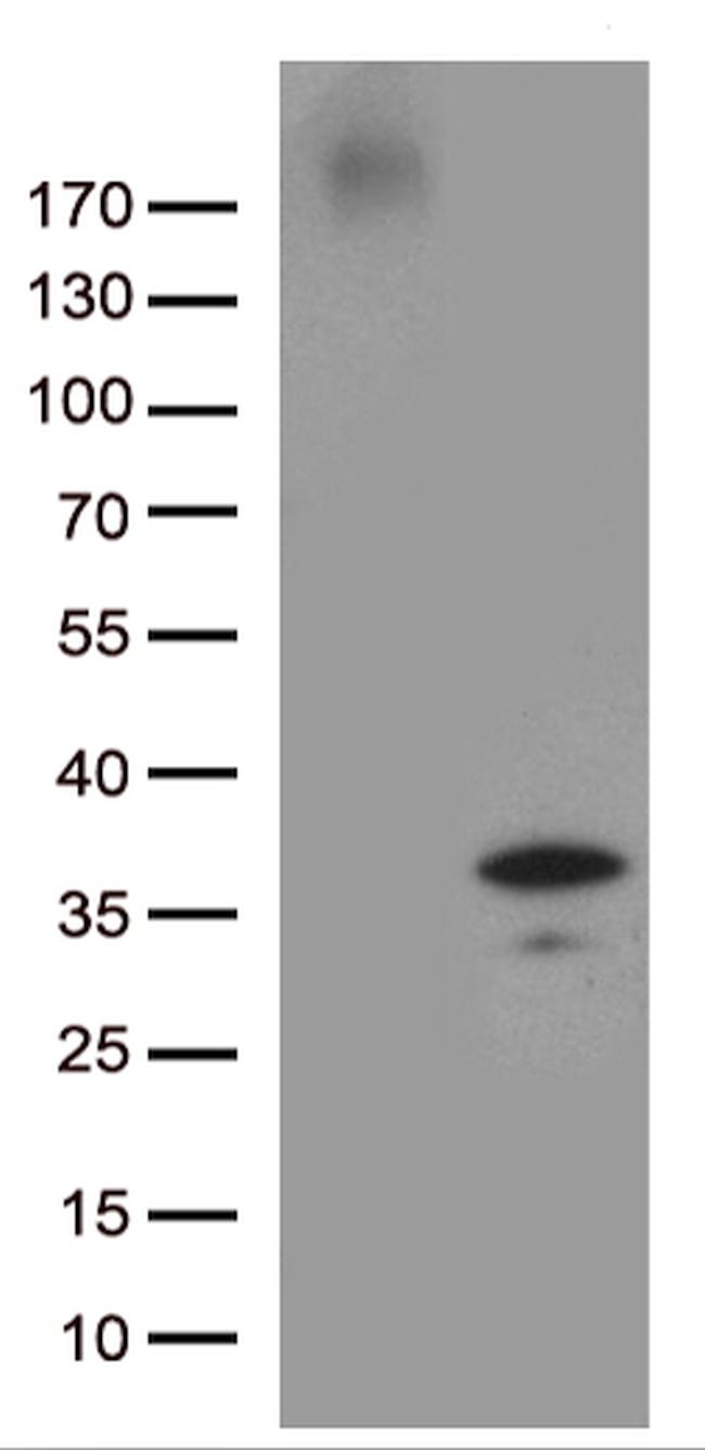 GRPEL1 Antibody in Western Blot (WB)