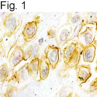 GRPR Antibody in Immunohistochemistry (IHC)
