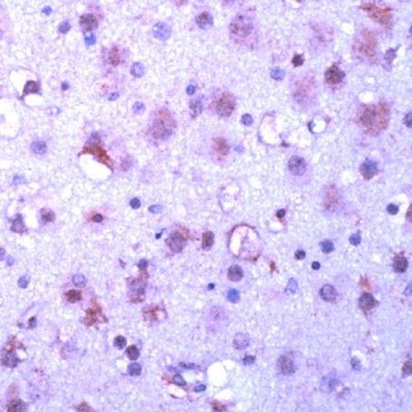 GSK3 alpha Antibody in Immunohistochemistry (IHC)