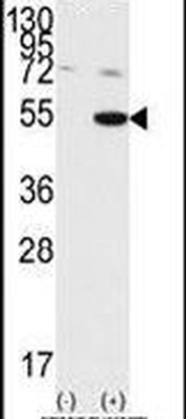 GSK3 alpha Antibody in Western Blot (WB)