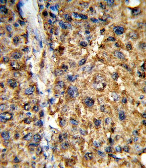 GSTA2 Antibody in Immunohistochemistry (IHC)