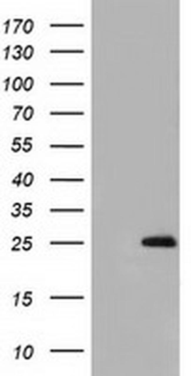 GSTA4 Antibody in Western Blot (WB)