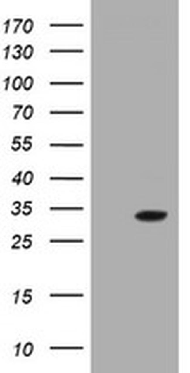 GSTO2 Antibody in Western Blot (WB)