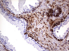 GSTP1 Antibody in Immunohistochemistry (Paraffin) (IHC (P))